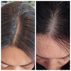 Hair La Vie Clinical Formula Hair Vitamins with Biotin & Saw PalmettoExp 04/2027